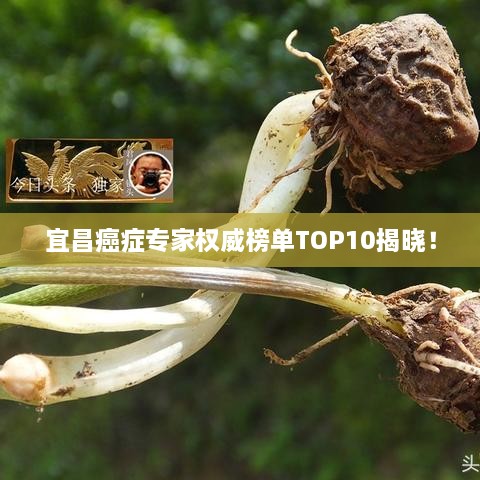 宜昌癌症专家权威榜单TOP10揭晓！